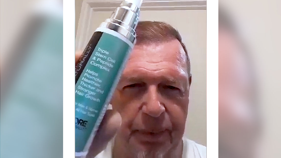 "My hair started growing back in!" How Barry avoided family hair loss with More Hair Naturally